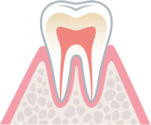 歯周病健康な状態